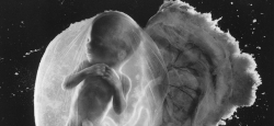The &#039;greatest photograph of the century&#039; was of an aborted child